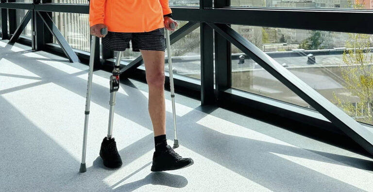 У Львові запрацює новий центр протезування на базі медуніверситету