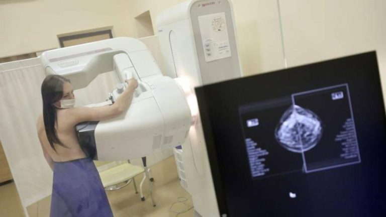 Де у Львові зробити безкоштовну мамографію і коли на це записатися