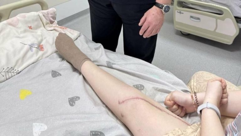 У Львові хірурги зберегли ногу 16-річної пацієнтки після остеосаркоми