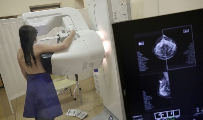 Жительок Львова запрошують на березневе обстеження