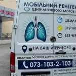 Мобільний рентген Центру легеневого здоров’я відвідає громади Львівщини