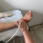 На Львівщині медики зберегли чоловікові ногу від ампутації
