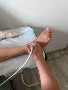 На Львівщині медики зберегли чоловікові ногу від ампутації