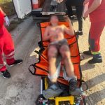Небезпечне селфі на даху вагона: 13-річного львів’янина вразило струмом