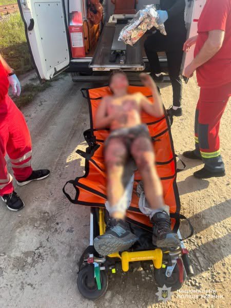 Небезпечне селфі на даху вагона: 13-річного львів’янина вразило струмом